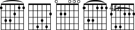 Frets